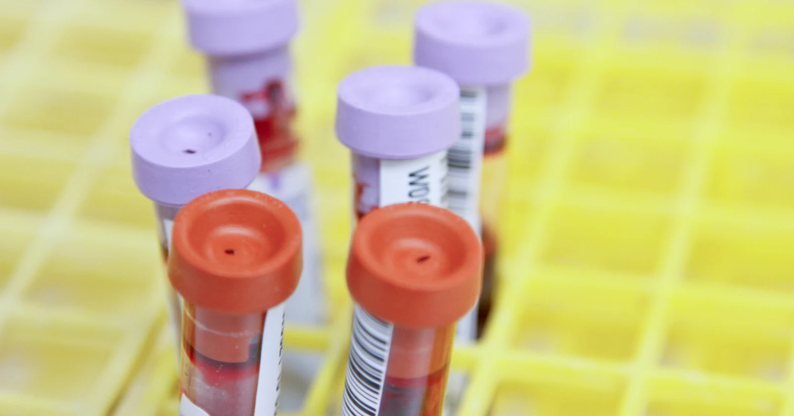 Laboratory sample collection supplies on a white surface.