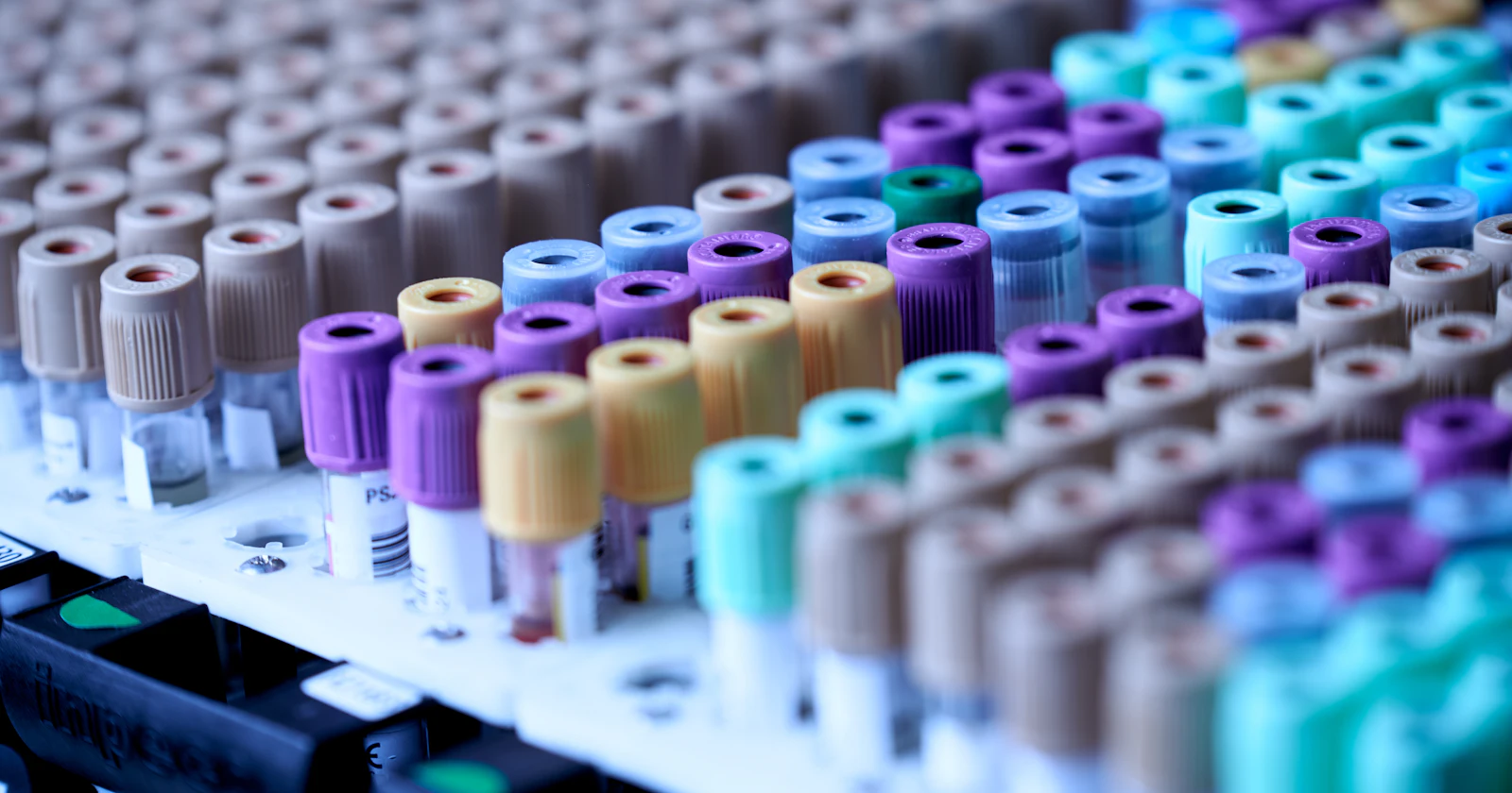 Rows of blood collection tubes with colored caps arranged in a laboratory rack.