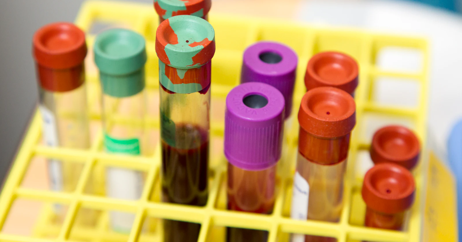 Blood collection tubes with red, purple and green caps standing in a yellow laboratory rack.
